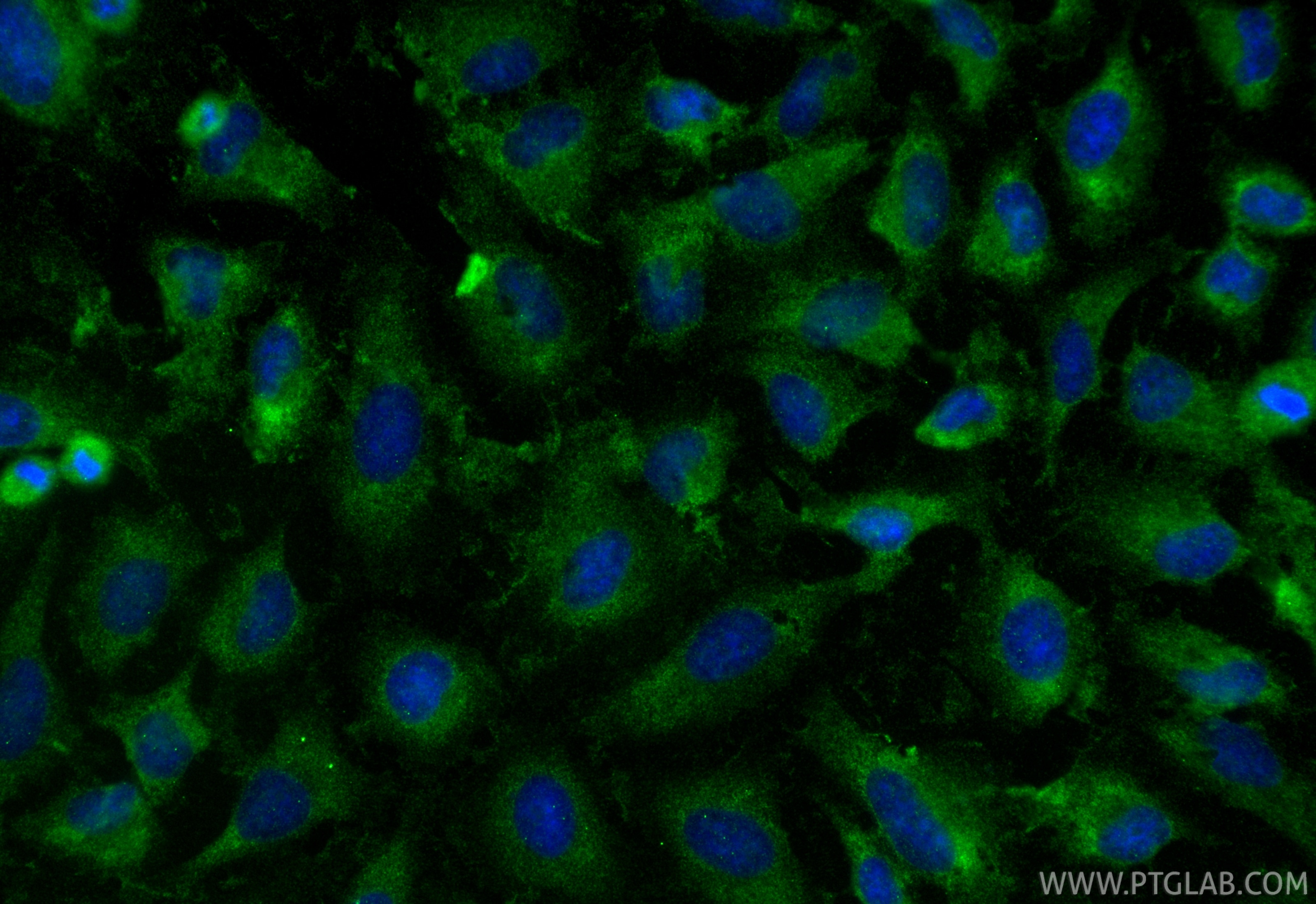 Immunofluorescence (IF) / fluorescent staining of HeLa cells using Multi-rAb® HPRT Multi-Recombinant antibody (RMX00095)