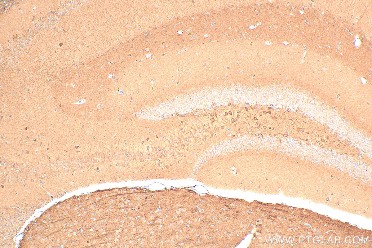 Immunohistochemistry (IHC) staining of mouse brain tissue using Multi-rAb® HPRT Multi-Recombinant antibody (RMX00095)