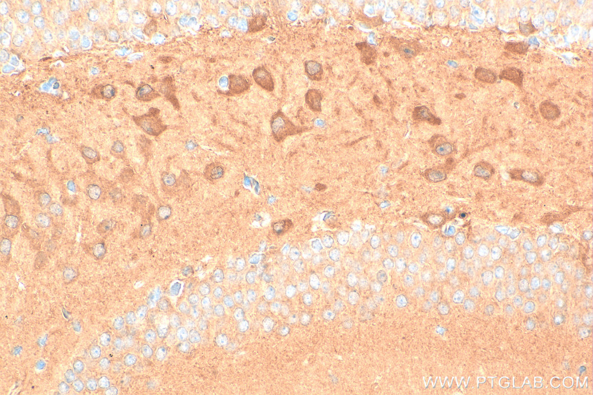 Immunohistochemistry (IHC) staining of mouse brain tissue using Multi-rAb® HPRT Multi-Recombinant antibody (RMX00095)