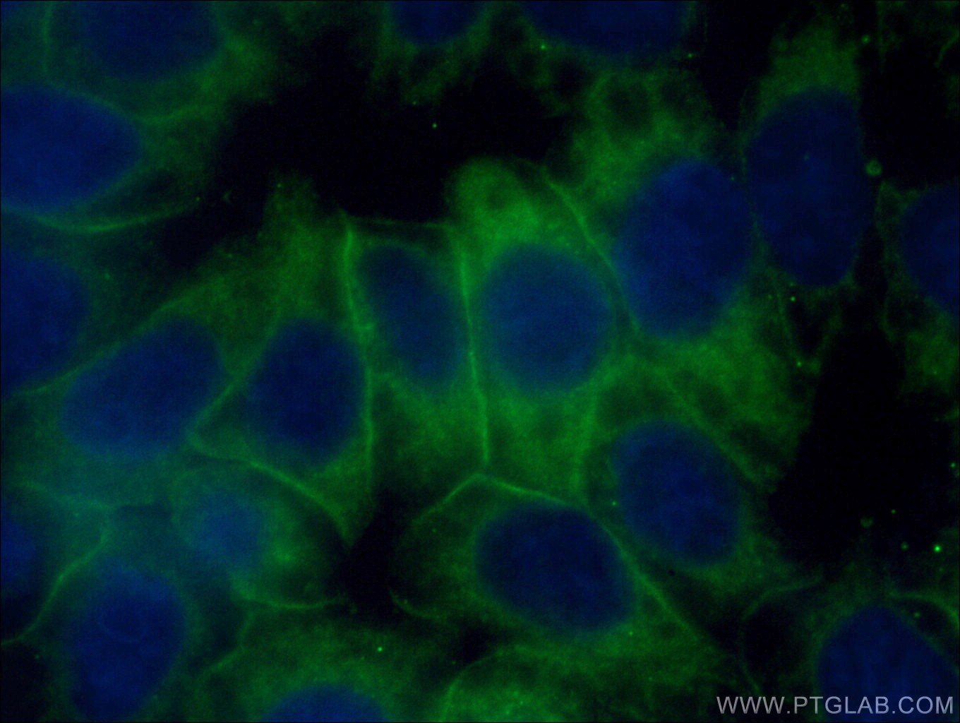 Immunofluorescence (IF) / fluorescent staining of HeLa cells using HPRT1 Polyclonal antibody (15059-1-AP)
