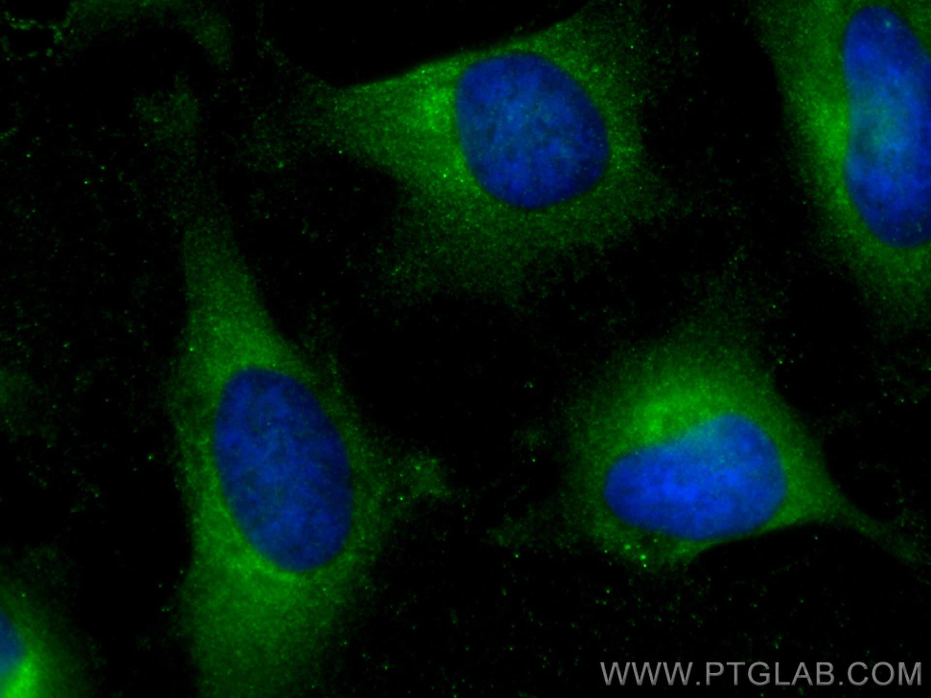 IF Staining of HeLa using 15059-1-AP