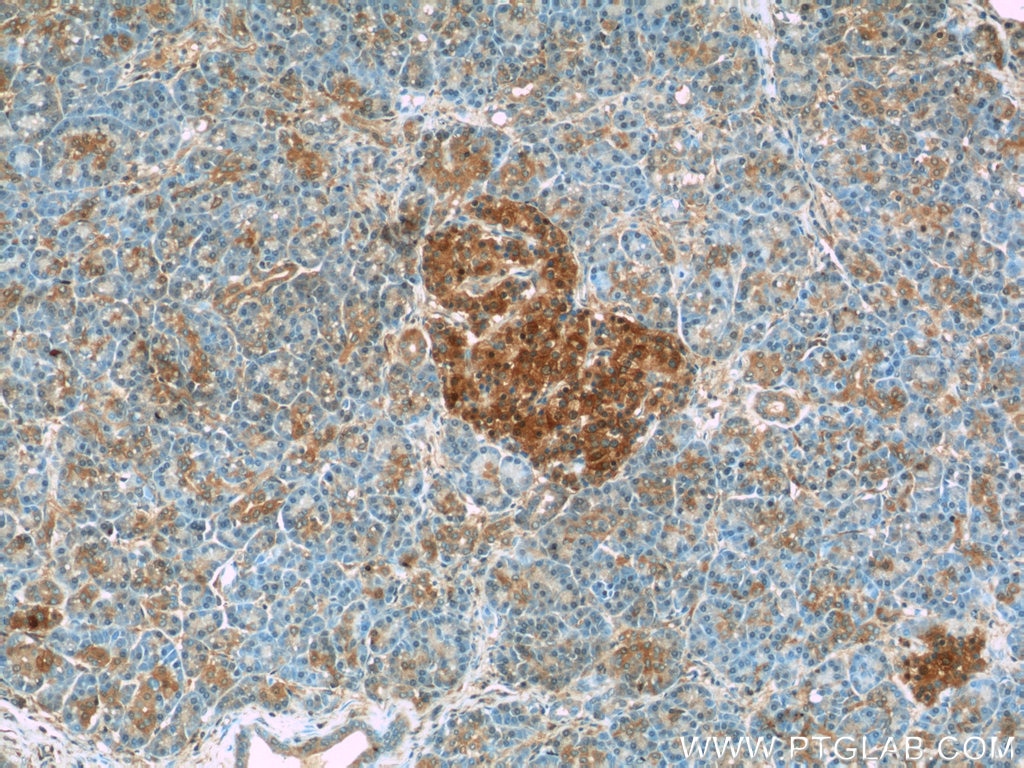 Immunohistochemistry (IHC) staining of human pancreas tissue using HPRT Polyclonal antibody (15059-1-AP)