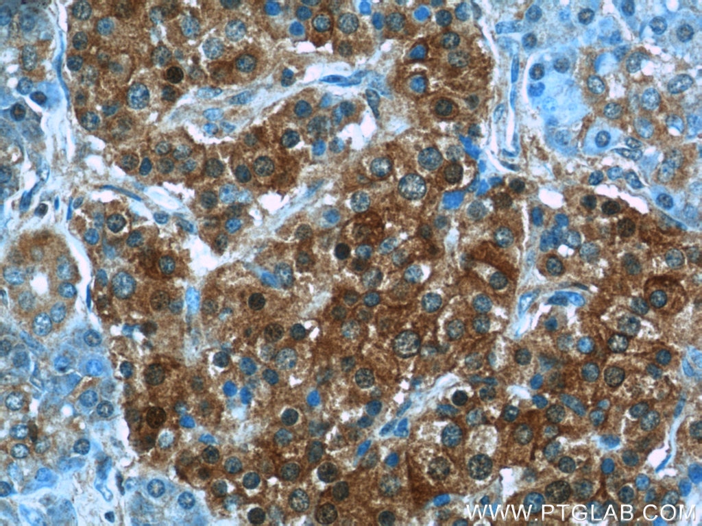 Immunohistochemistry (IHC) staining of human pancreas tissue using HPRT1 Polyclonal antibody (15059-1-AP)