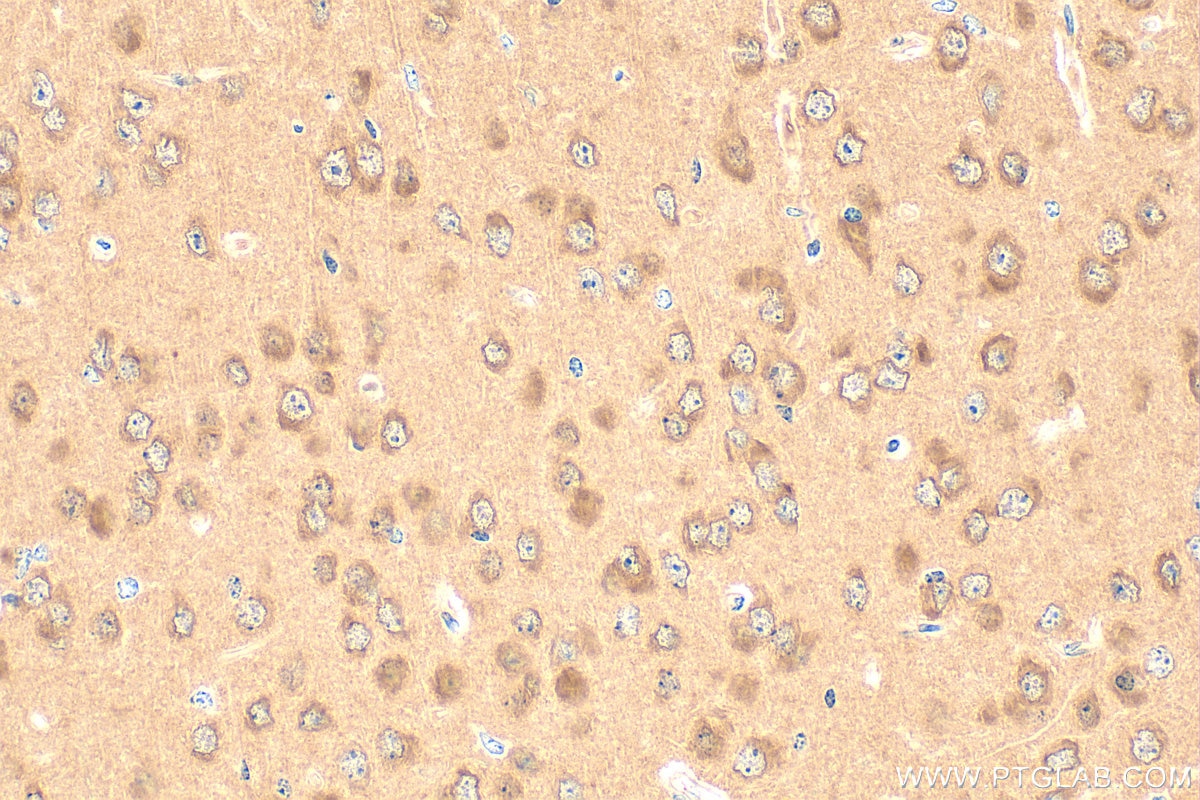 Immunohistochemistry (IHC) staining of mouse brain tissue using HPRT Polyclonal antibody (15059-1-AP)