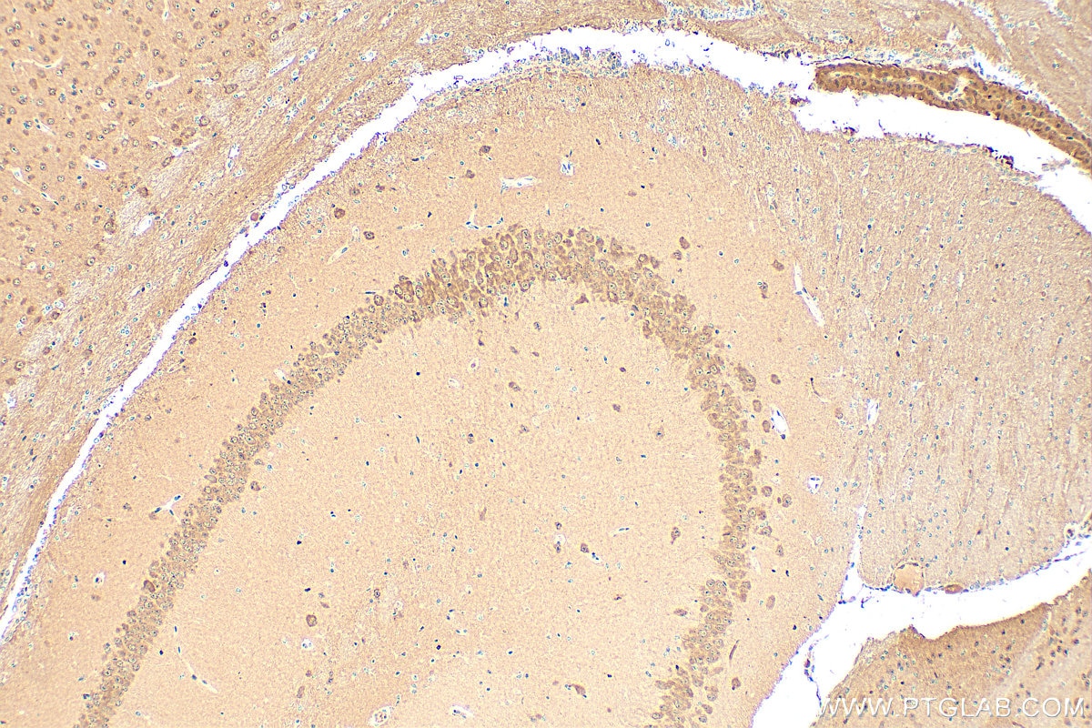 Immunohistochemistry (IHC) staining of mouse brain tissue using HPRT Polyclonal antibody (15059-1-AP)