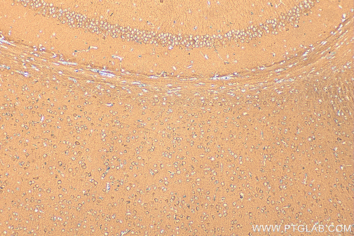 Immunohistochemistry (IHC) staining of mouse brain tissue using HPRT Polyclonal antibody (15059-1-AP)