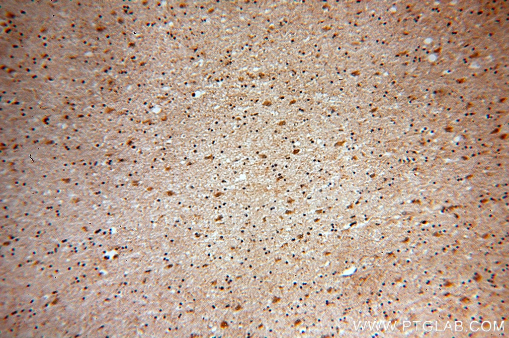 Immunohistochemistry (IHC) staining of human brain tissue using HPRT1 Polyclonal antibody (15059-1-AP)