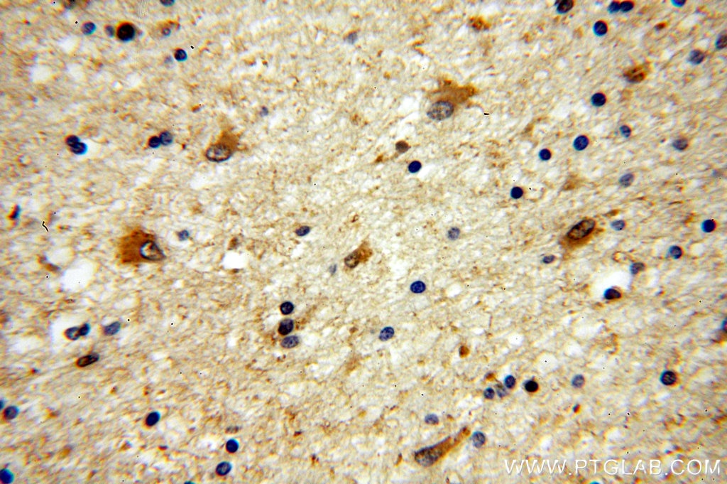 Immunohistochemistry (IHC) staining of human brain tissue using HPRT1 Polyclonal antibody (15059-1-AP)