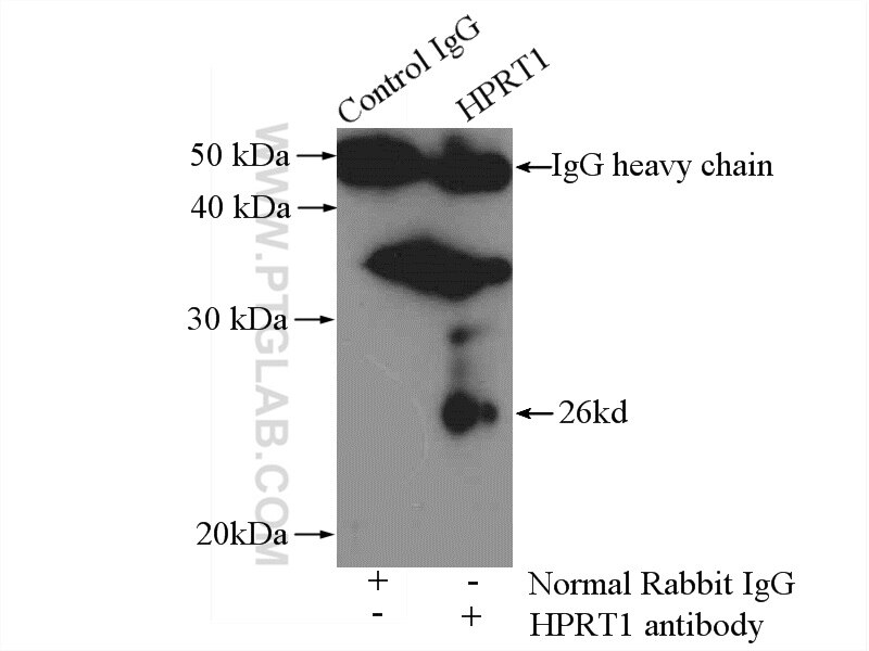 Immunoprecipitation (IP) experiment of mouse liver tissue using HPRT1 Polyclonal antibody (15059-1-AP)