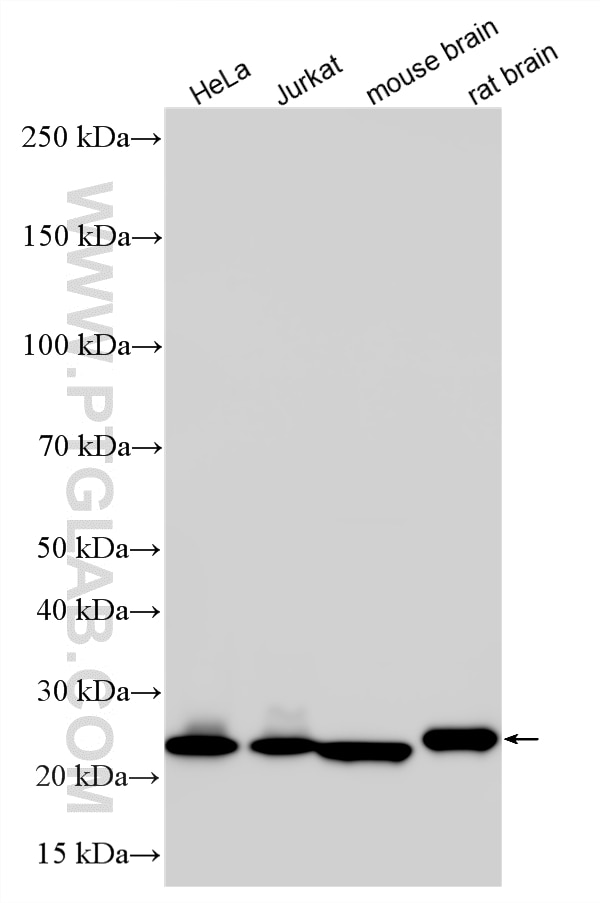 Western Blot (WB) analysis of various lysates using HPRT Polyclonal antibody (15059-1-AP)