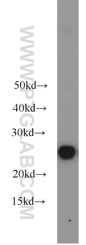 Western Blot (WB) analysis of MCF-7 cells using HPRT1 Polyclonal antibody (15059-1-AP)