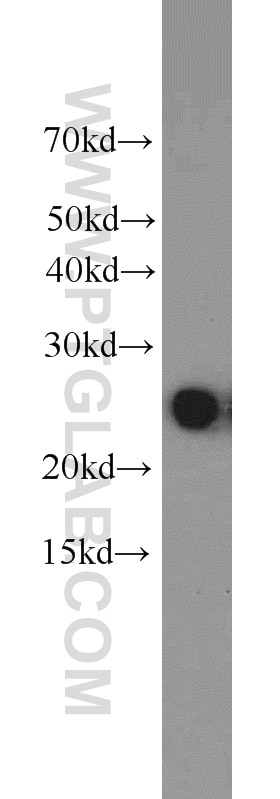 Western Blot (WB) analysis of A549 cells using HPRT1 Polyclonal antibody (15059-1-AP)
