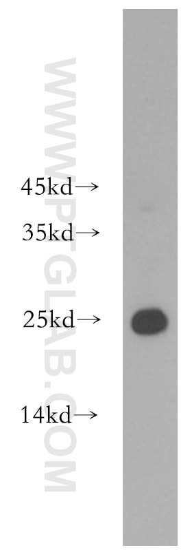 Western Blot (WB) analysis of mouse liver tissue using HPRT1 Polyclonal antibody (15059-1-AP)