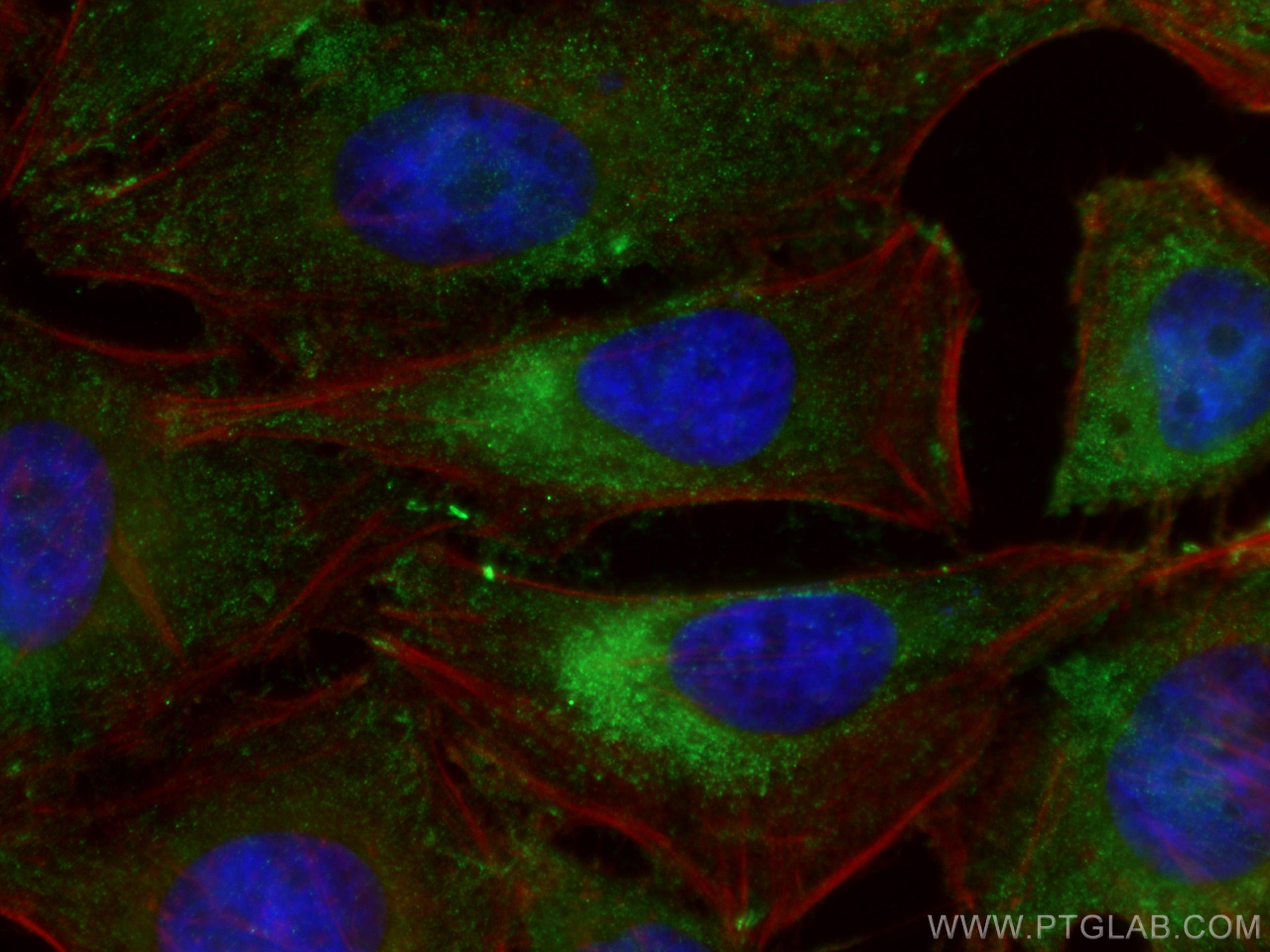 Immunofluorescence (IF) / fluorescent staining of HeLa cells using HPRT1 Monoclonal antibody (67518-1-Ig)