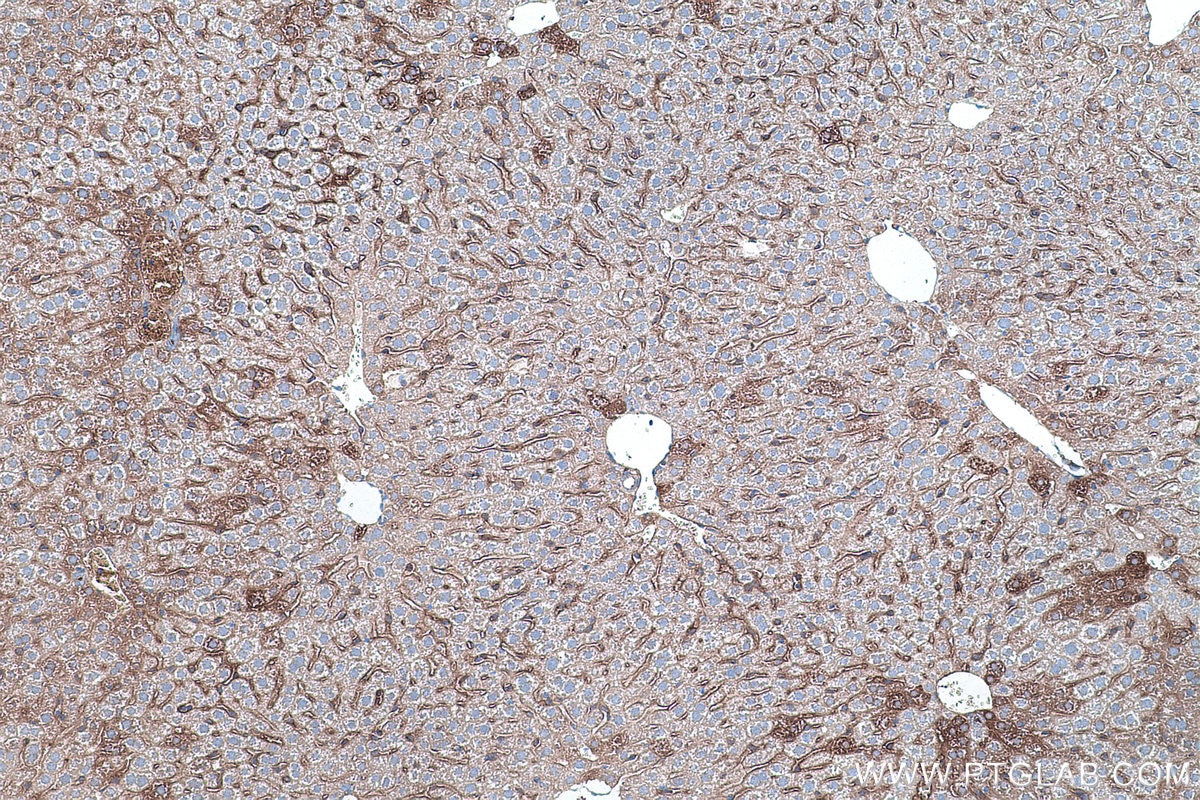 Immunohistochemistry (IHC) staining of mouse liver tissue using HPRT1 Monoclonal antibody (67518-1-Ig)