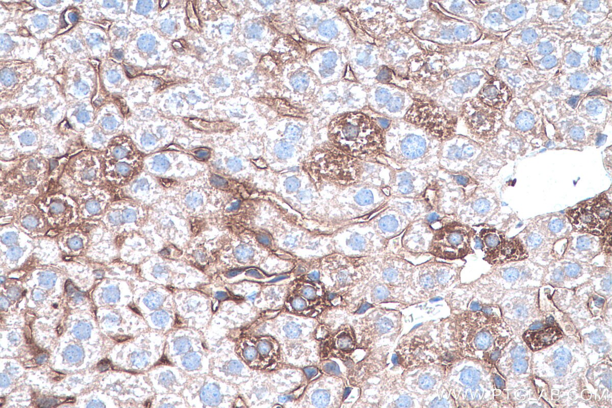 Immunohistochemistry (IHC) staining of mouse liver tissue using HPRT1 Monoclonal antibody (67518-1-Ig)