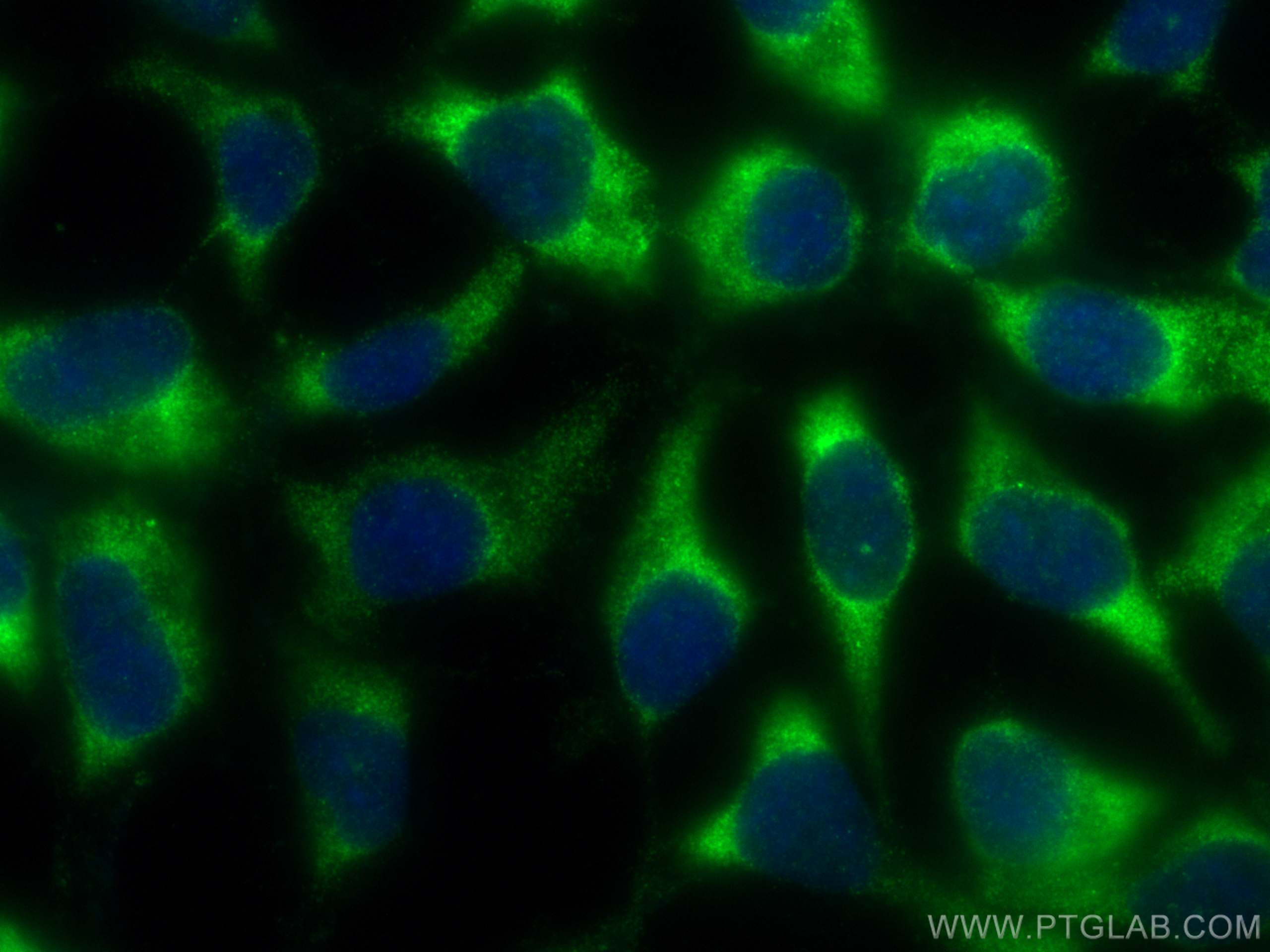 Immunofluorescence (IF) / fluorescent staining of HEK-293 cells using HPS1 Polyclonal antibody (15077-1-AP)