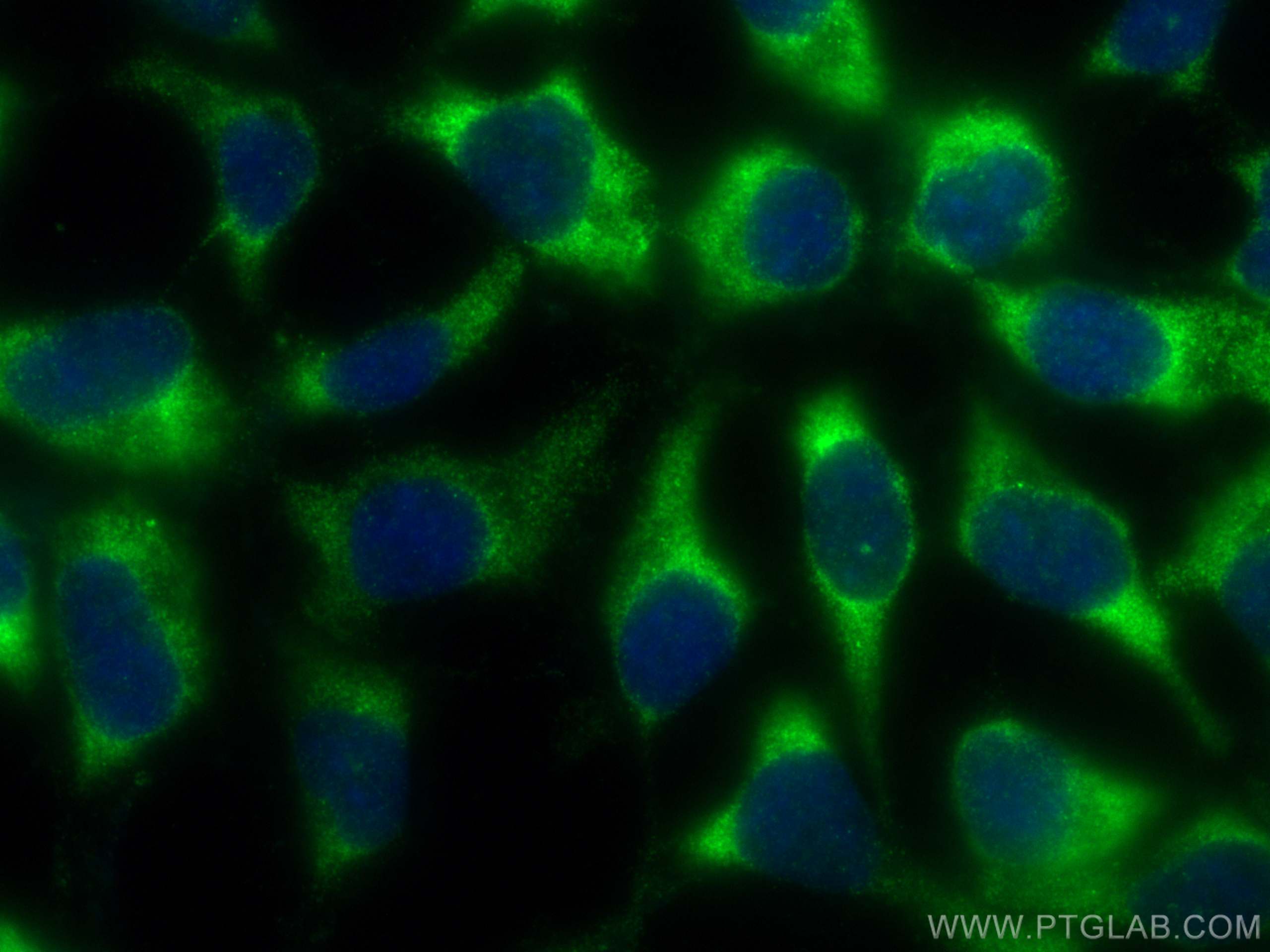 IF Staining of HEK-293 using 15077-1-AP