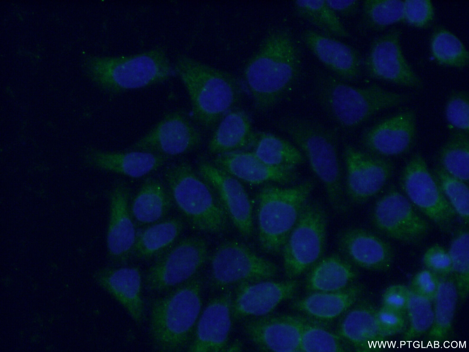 Immunofluorescence (IF) / fluorescent staining of L02 cells using HPS1 Polyclonal antibody (15077-1-AP)