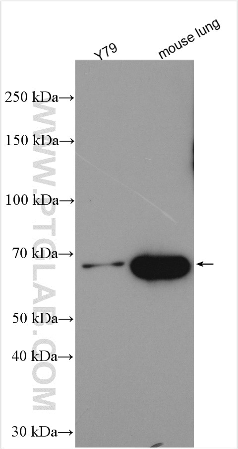 Western Blot (WB) analysis of various lysates using HPS1 Polyclonal antibody (15077-1-AP)