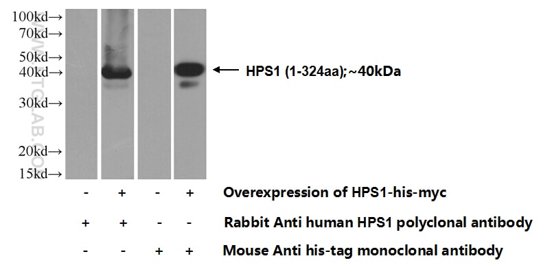 Western Blot (WB) analysis of Transfected HEK-293 cells using HPS1 Polyclonal antibody (15077-1-AP)