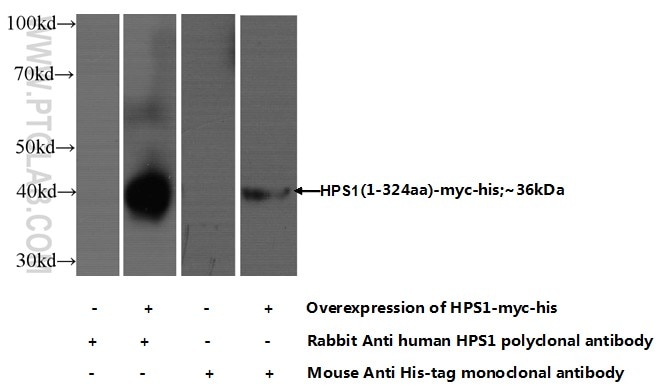 Western Blot (WB) analysis of HEK-293 cells using HPS1 Polyclonal antibody (15077-1-AP)
