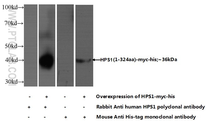 WB analysis of HEK-293 using 15077-1-AP