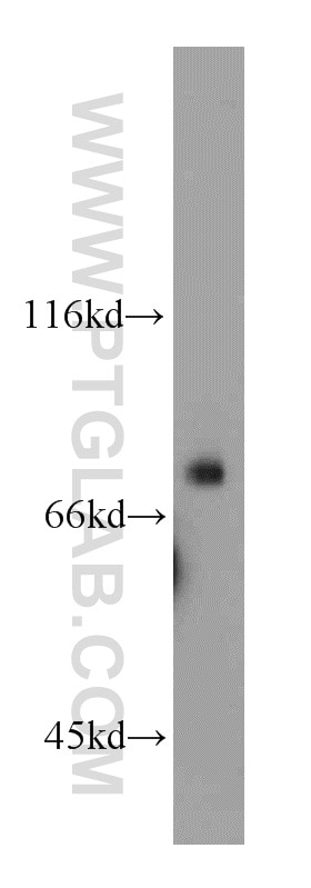 Western Blot (WB) analysis of Raji cells using HPS1 Polyclonal antibody (15077-1-AP)
