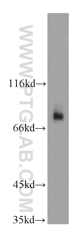 Western Blot (WB) analysis of L02 cells using HPS1 Polyclonal antibody (15077-1-AP)