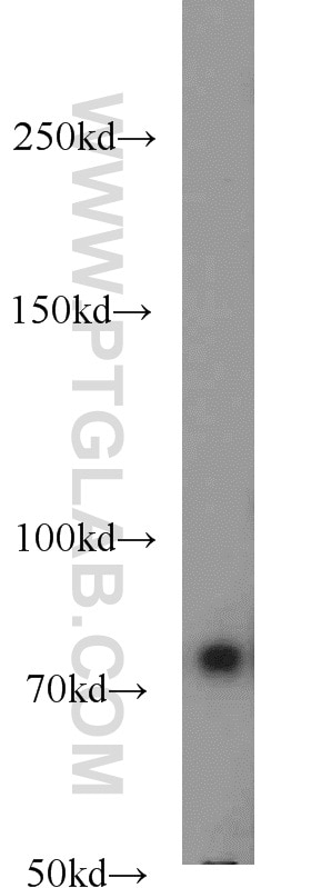 WB analysis of K-562 using 15077-1-AP