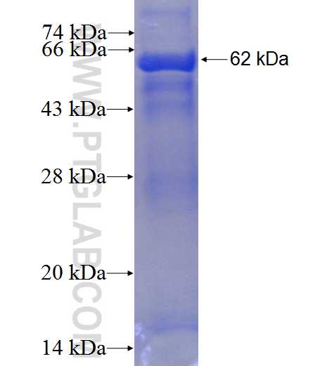 HPS1 fusion protein Ag7149 SDS-PAGE