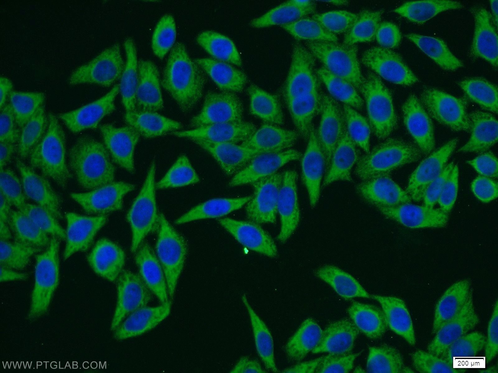 Immunofluorescence (IF) / fluorescent staining of HeLa cells using HPS3 Polyclonal antibody (10768-1-AP)