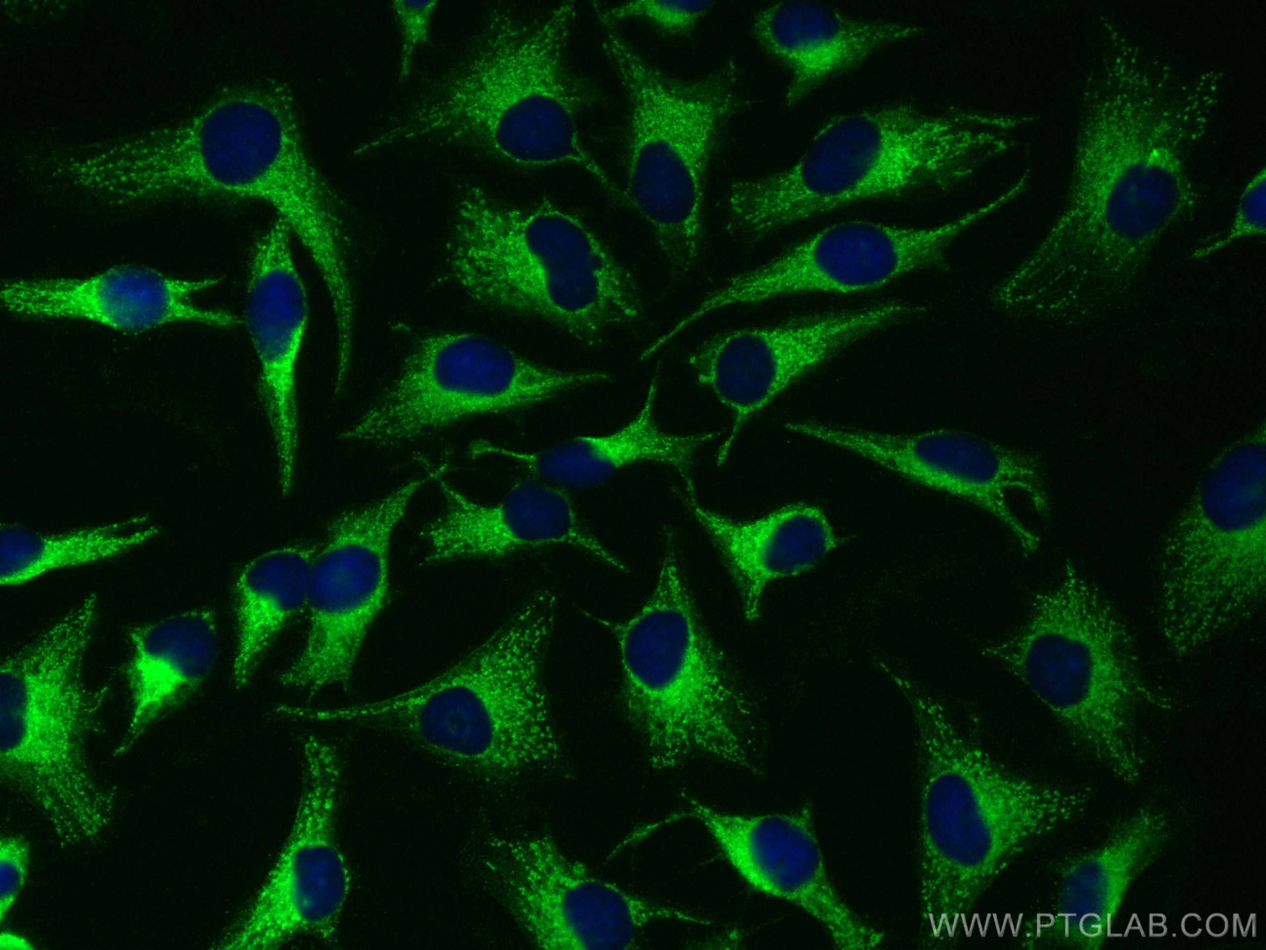 Immunofluorescence (IF) / fluorescent staining of HeLa cells using HPS3 Polyclonal antibody (10768-1-AP)