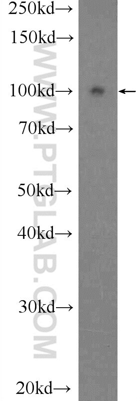 Western Blot (WB) analysis of HEK-293T cells using HPS3 Polyclonal antibody (10768-1-AP)