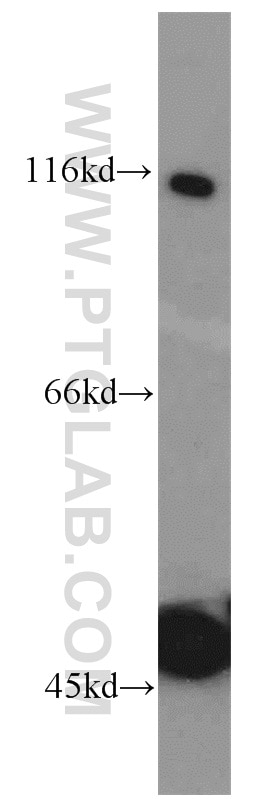 Western Blot (WB) analysis of HeLa cells using HPS3 Polyclonal antibody (10768-1-AP)