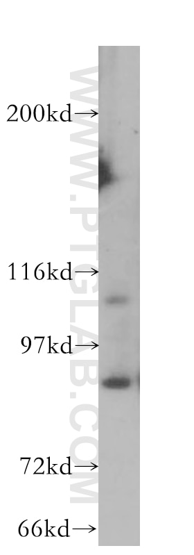 Western Blot (WB) analysis of HEK-293 cells using HPS3 Polyclonal antibody (10768-1-AP)