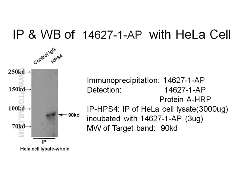 Immunoprecipitation (IP) experiment of Hela cells using HPS4 Polyclonal antibody (14627-1-AP)