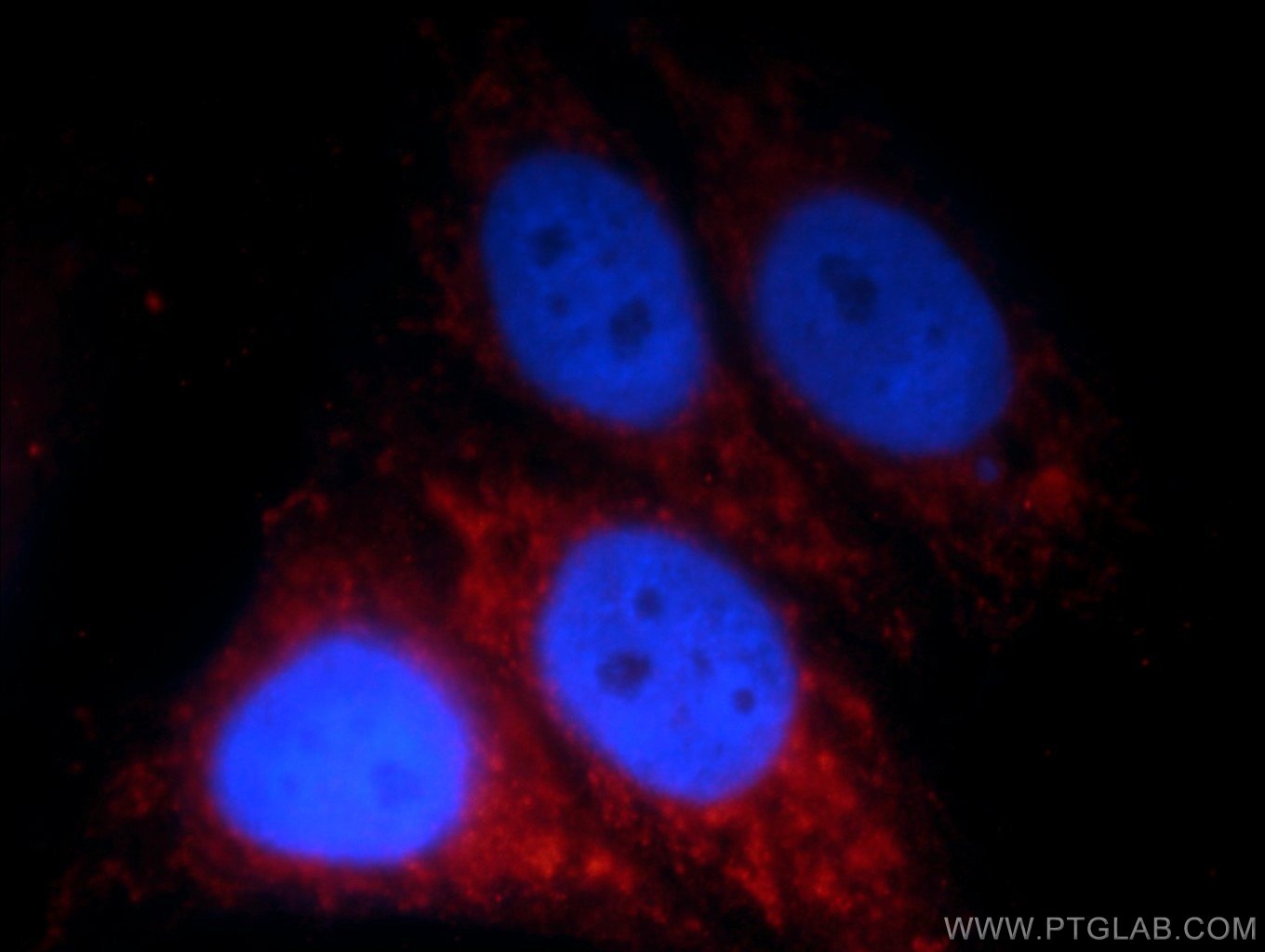 Immunofluorescence (IF) / fluorescent staining of HepG2 cells using HPS4 Polyclonal antibody (14627-1-AP)