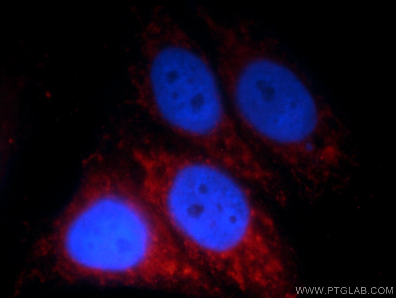 IF Staining of HepG2 using 14627-1-AP