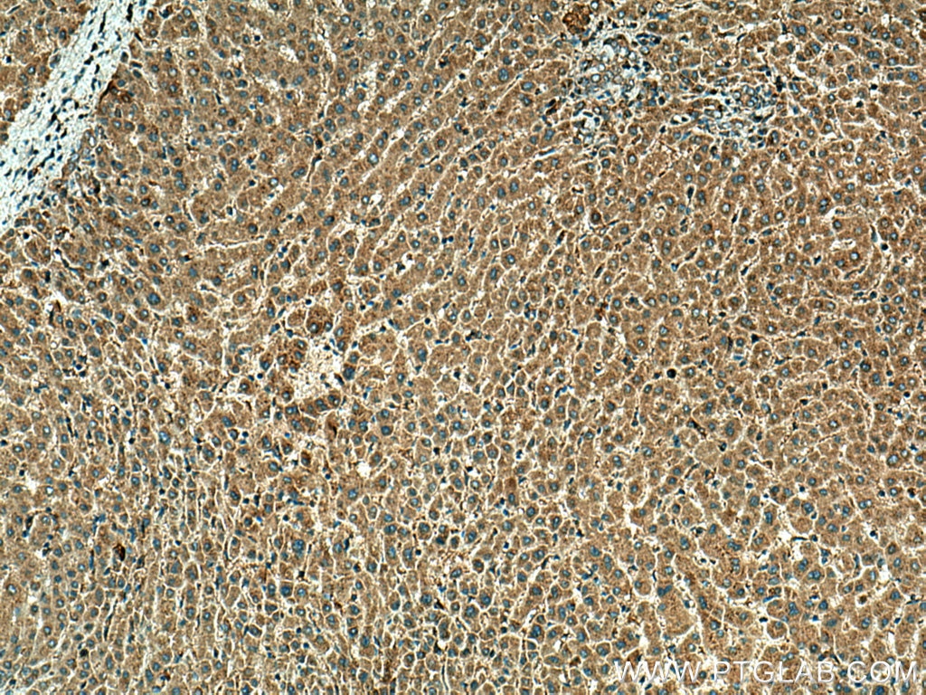 Immunohistochemistry (IHC) staining of human liver tissue using HPS4 Polyclonal antibody (14627-1-AP)