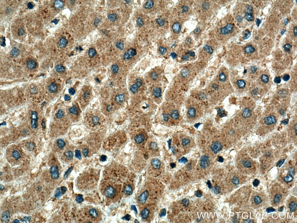 Immunohistochemistry (IHC) staining of human liver tissue using HPS4 Polyclonal antibody (14627-1-AP)