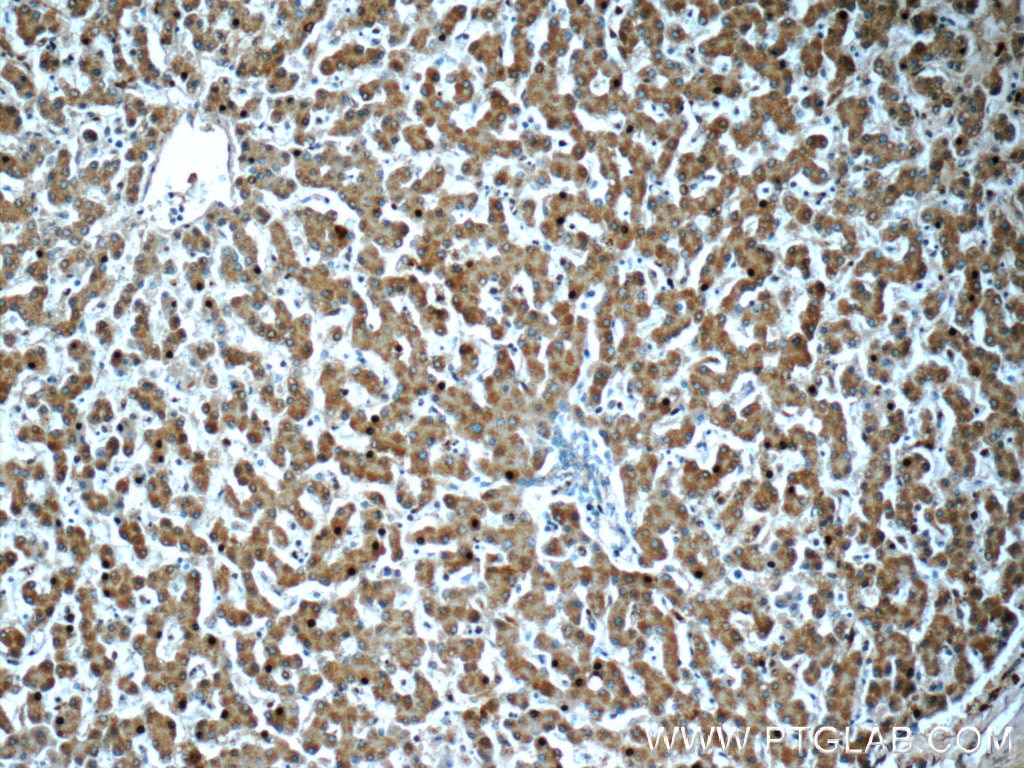 Immunohistochemistry (IHC) staining of human liver tissue using HPS4 Polyclonal antibody (14627-1-AP)