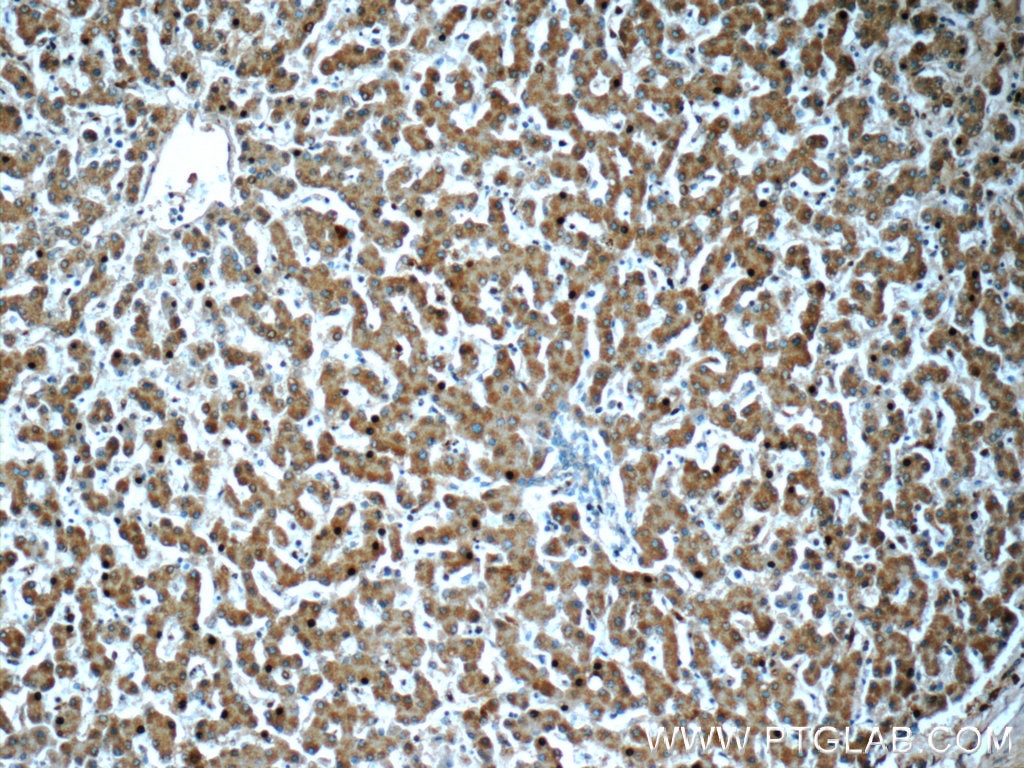 IHC staining of human liver using 14627-1-AP