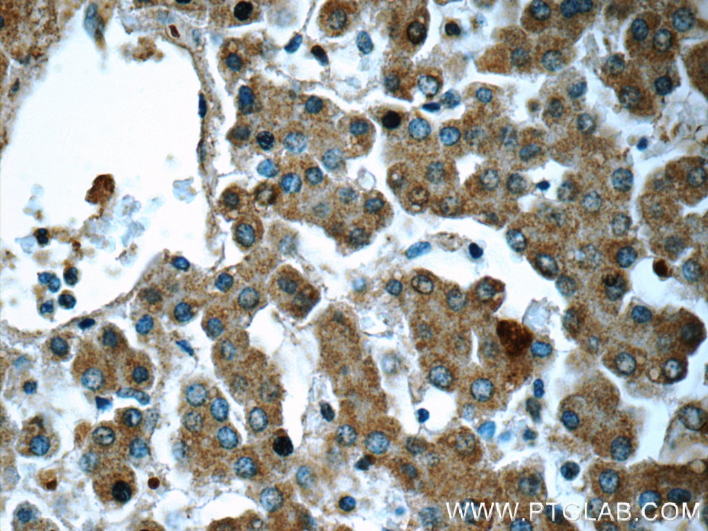 Immunohistochemistry (IHC) staining of human liver tissue using HPS4 Polyclonal antibody (14627-1-AP)