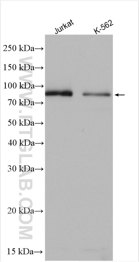 Western Blot (WB) analysis of various lysates using HPS4 Polyclonal antibody (14627-1-AP)