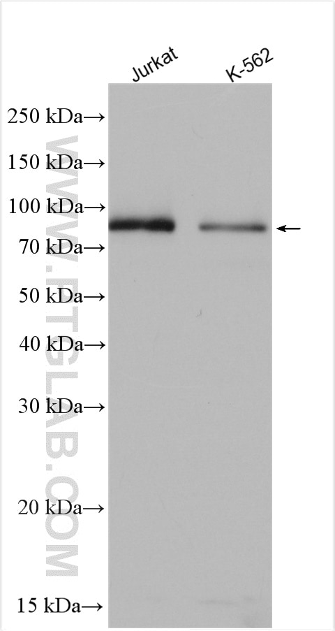 WB analysis using 14627-1-AP