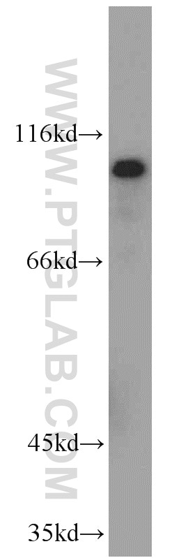 Western Blot (WB) analysis of A375 cells using HPS4 Polyclonal antibody (14627-1-AP)