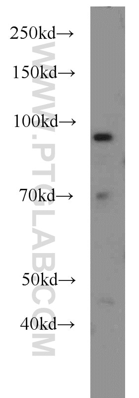 Western Blot (WB) analysis of HeLa cells using HPS4 Polyclonal antibody (14627-1-AP)