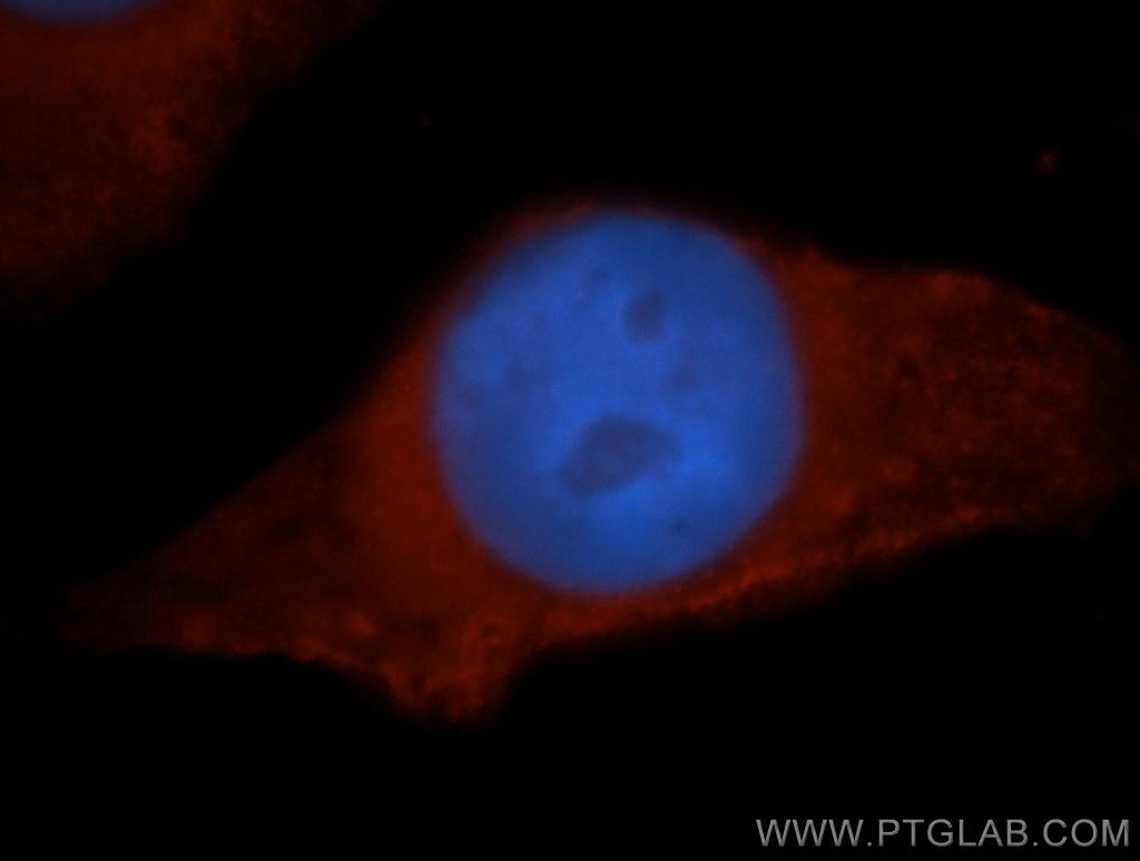 Immunofluorescence (IF) / fluorescent staining of MCF-7 cells using HPS5 Polyclonal antibody (13901-1-AP)