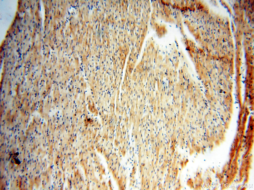 Immunohistochemistry (IHC) staining of human heart tissue using HPS5 Polyclonal antibody (13901-1-AP)